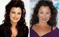 Did  Fran Drescher Had Plastic Surgery? Find It Out Here